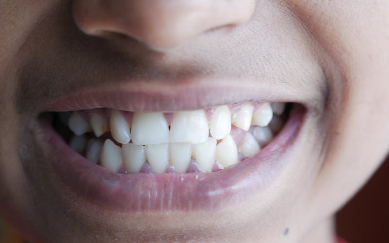 Loš zadah: uzroci kojih niste svjesni i što pomoći