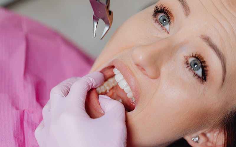 Strah od zubara: zašto se javlja i kako se s njim nositi