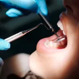 Mouth ulcers: causes, treatment, and when to worry