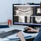 Wisdom tooth: symptoms, complications, and when removal is needed