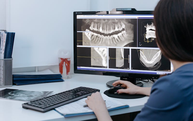 Umnjak: simptomi, komplikacije i kada vaditi