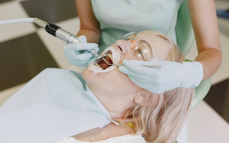 Zubni kamenac: zašto nastaje i kako ga ukloniti